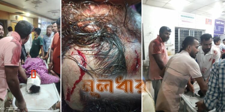 ডাকাতি-লুট : চিনে ফেলায় কুপিয়ে যখম!