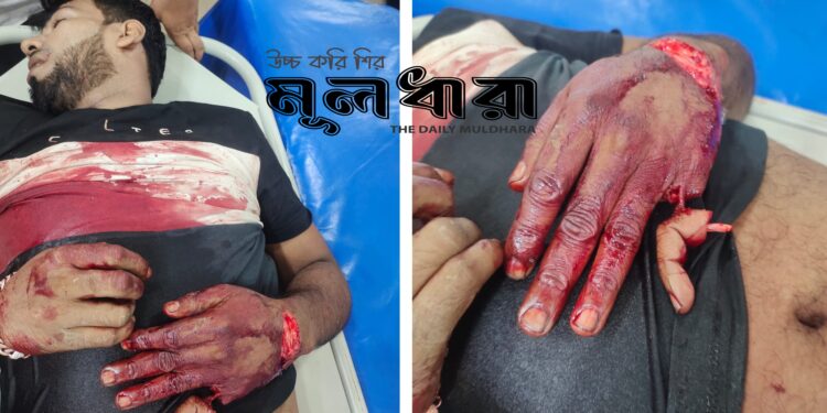 চাঁদা দেয়নি, হাতের কবজি গেল প্রবাসীর !