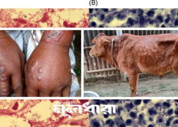 অ্যানথ্রাক্স : আতঙ্ক, সচেতনতা ও ব্যবস্থাপনা