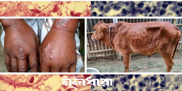 অ্যানথ্রাক্স : আতঙ্ক, সচেতনতা ও ব্যবস্থাপনা